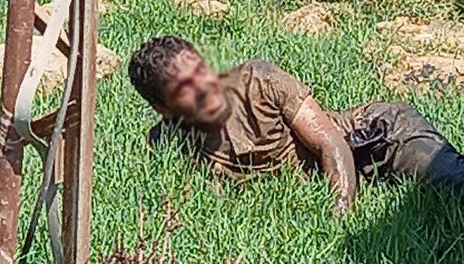 Şanlıurfa'da kuduz hastası hastaneden kaçtı: Vatandaşlar paniğe kapıldı