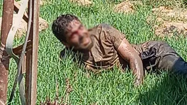 Şanlıurfa'da kuduz hastası hastaneden kaçtı: Vatandaşlar paniğe kapıldı