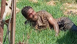 Şanlıurfa'da kuduz hastası hastaneden kaçtı: Vatandaşlar paniğe kapıldı Şanlıurfa'da kuduz hastası hastaneden kaçtı: Vatandaşlar paniğe kapıldı