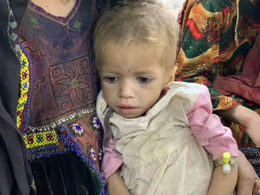 İnsanlık dramı: Sütten kesilen Afgan annelerin bebekleri büyüyemiyor 9 İnsanlık dramı: Sütten kesilen Afgan annelerin bebekleri büyüyemiyor 9