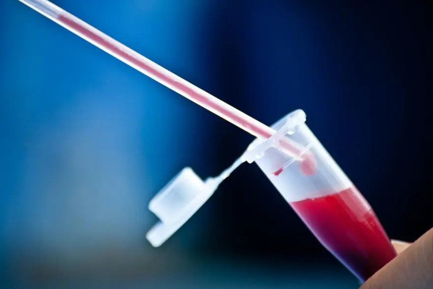 Kansere en yatkın kan grupları belli oldu: Risk yüzde 55 daha fazla 2