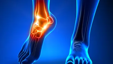 Tarsal tünel sendromu ayakları vuruyor