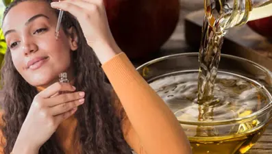 Güneş lekelerini açan doğal yöntem! 15 gün her gece yapınca cilt iz, yara, lekeden eser bırakmıyor