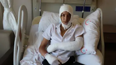 Elindeki elektronik sigara bomba gibi patladı