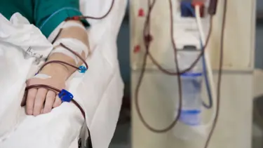 "Corona virüs diyaliz hastalarında ateş yapmayabilir" (60 bin diyaliz hastasına  corona virüs uyarısı)