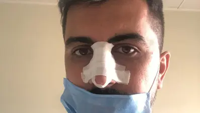 Hasta yakını, sosyal mesafe uyarısı yapan hemşirenin burnunu kırdı