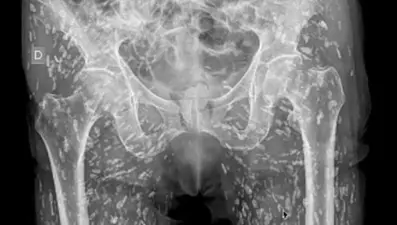 Acil doktoru şaşkına döndü: Gördüğüm en garip röntgenlerden biri