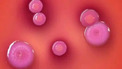 Endonezya'da 27 kişi şarbona yakalandı