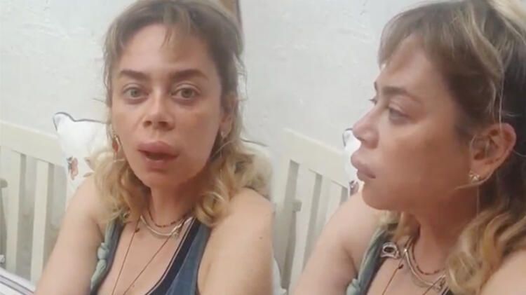 Demet Evgar dudağını arı sokmasını ti'ye aldı: Dolgu yaptırdım