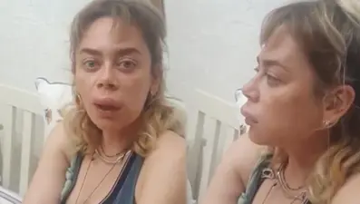 Demet Evgar dudağını arı sokmasını ti'ye aldı: Dolgu yaptırdım