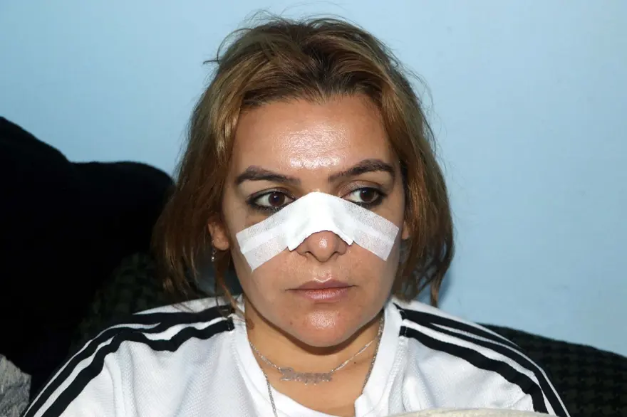 Roman ailelerin fahri koordinatörüne saldırı 5