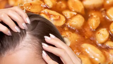 Uzmanı uyarıyor:  Bu besin saç dökülmesini hızlandırıyor