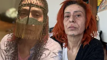 Yüzünde yanıklar oluşmuştu: Yıldız Tilbe maskeyle poz verdi