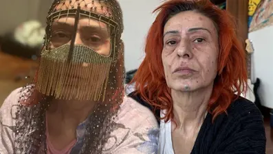 Yüzünde yanıklar oluşmuştu: Yıldız Tilbe maskeyle poz verdi