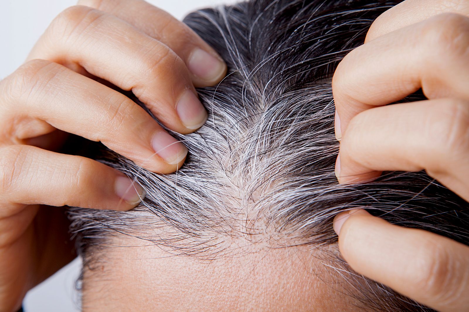 Saçlarınız erken yaşta beyazladı mı? Melanin üretimi için 5 temel vitamin