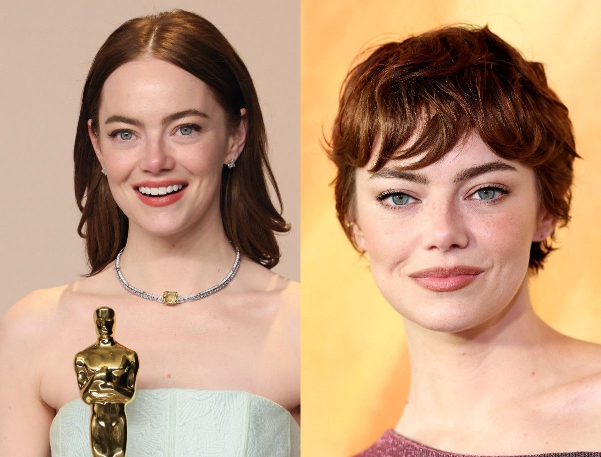 Oscar ödüllü oyuncu Emma Stone'un yüzündeki değişim gündem oldu