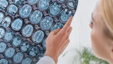 13 haftada 9 ameliyat geçirdi: Kafatasını midesinde taşıdı