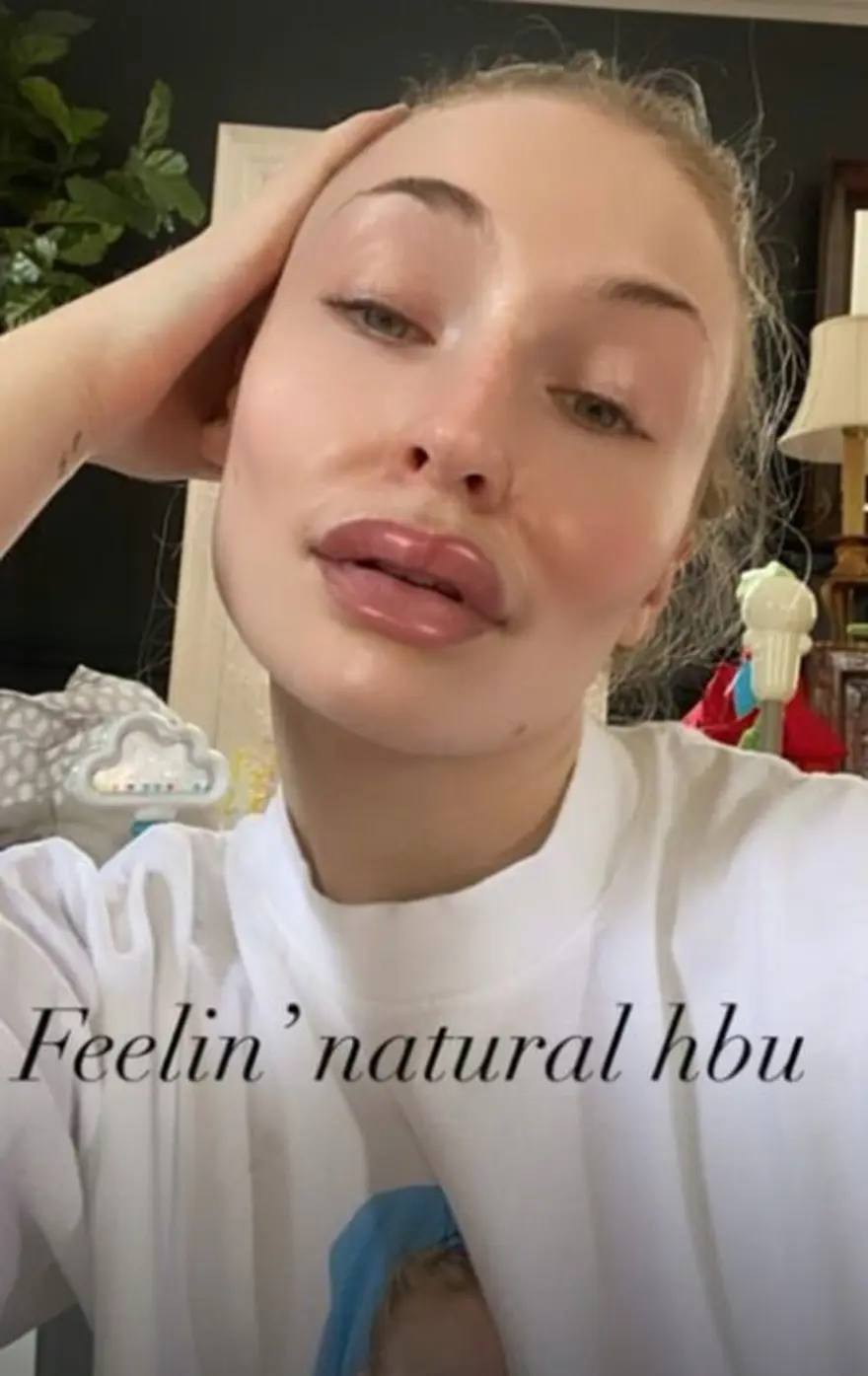 Instagram filtresiyle ünlülerin estetikli halleri 1