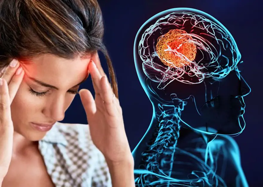Beyin iltihabının en sinsi belirtisi: Erken fark edilmezse ölüme götürüyor, her şey 3 saat içinde oluyor 