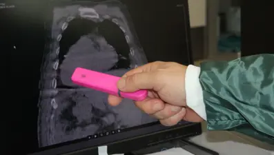 Türkiye'de de dünyada da ilk! Giresun Sendromu olarak tıp literatürüne girdi