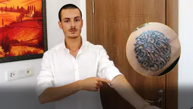 Sildirmek istediği dövmeler kabusu oldu