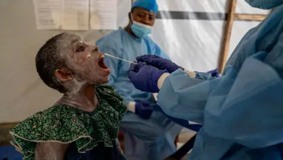 İki gün içinde öldüren gizemli salgın: 50'den fazla kişi hayatını kaybetti, nedeni yarasa eti olabilir!