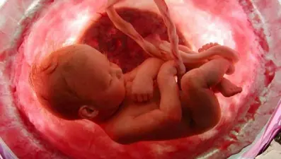 “Riskli bebeklerde gelişim geriliği olasılığı yüksek”