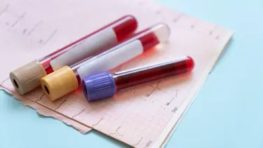 Erken tanıda devrim: 50’den fazla kanser türünü tespit eden kan testi