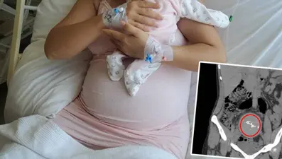 Doğumda unutuldu, iki yıl sonra ortaya çıktı: Gazlı bez ihmaline soruşturma