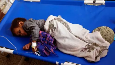 Yemen'de 6 ayda 63 bin kolera vakası görüldü