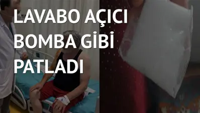 Toz ve sıvı maddeyi karıştırınca kollarında yanıklar oluştu