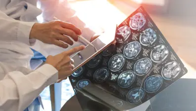 Nöroloji Uzmanı uyarıyor: Ağır Covid-19 geçirenler risk altında