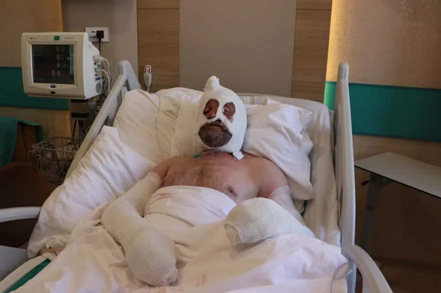 “EVDEKİ YANGINDAN CAMDAN ATLAYARAK KURTULDU” 2 “EVDEKİ YANGINDAN CAMDAN ATLAYARAK KURTULDU” 2