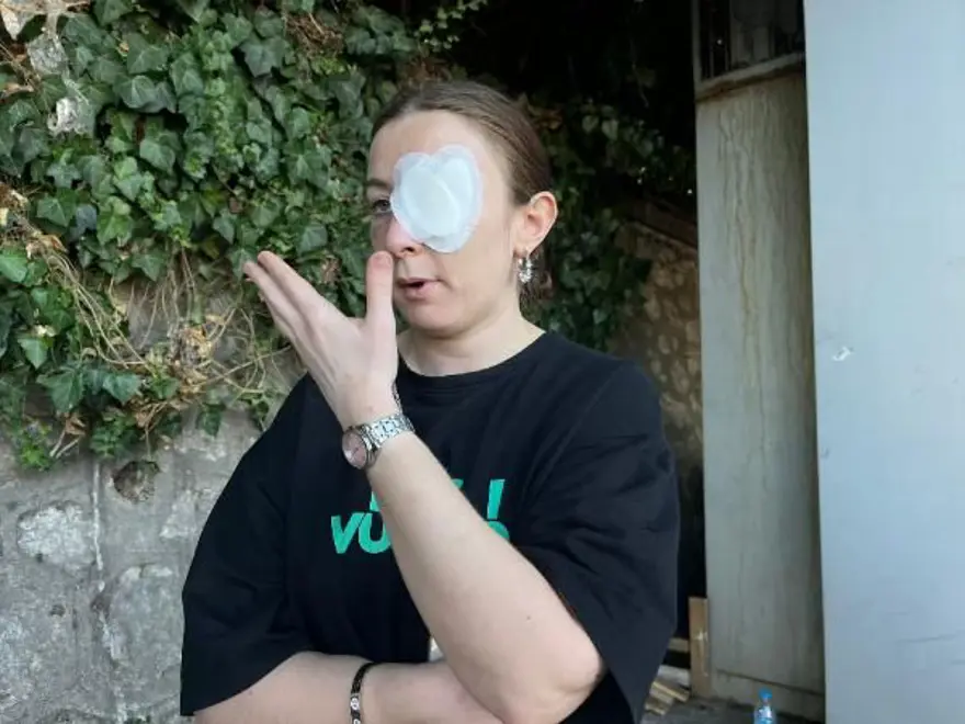 Eski sevgiliye 9 kafa darbesine 5 yıl 2 ay hapis 6