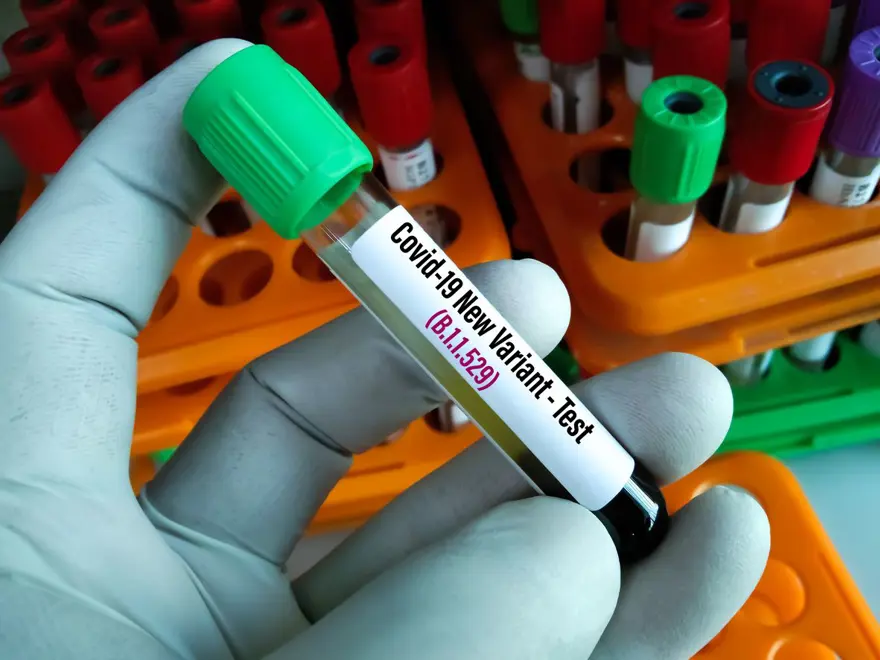 Covid-19'a karşı antikorlarınız ne kadar güçlü? Cinsiyetinize ve yaşınıza bağlı olarak değişiyor 11