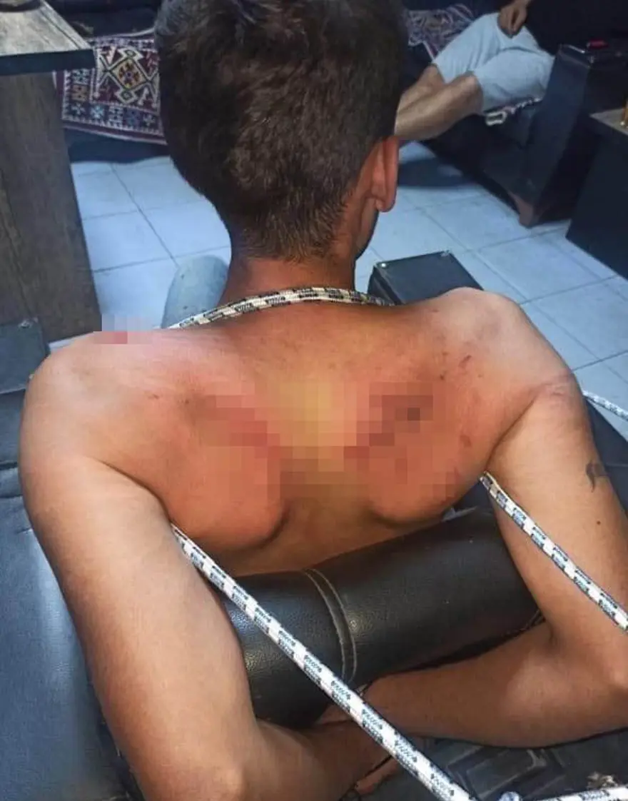 Antalya’da 2 gün süren korkunç işkencenin görüntüleri: Hamam böceği yedirip, dişlerini kerpetenle çektiler 