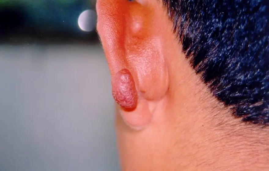 "SİVRİSİNEKLE MÜCADELE ETMEKTEN DAHA ZOR" 3