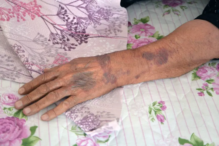 Yaşlı kadına akraba dehşeti: Banyoda çekiçle dövüp, yüzüğünü ve cep telefonunu çaldı 2 Yaşlı kadına akraba dehşeti: Banyoda çekiçle dövüp, yüzüğünü ve cep telefonunu çaldı 2