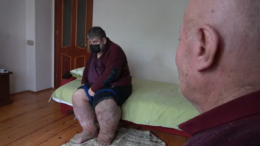 Sivrisinek ısırığı hayatını kararttı 2 Sivrisinek ısırığı hayatını kararttı 2