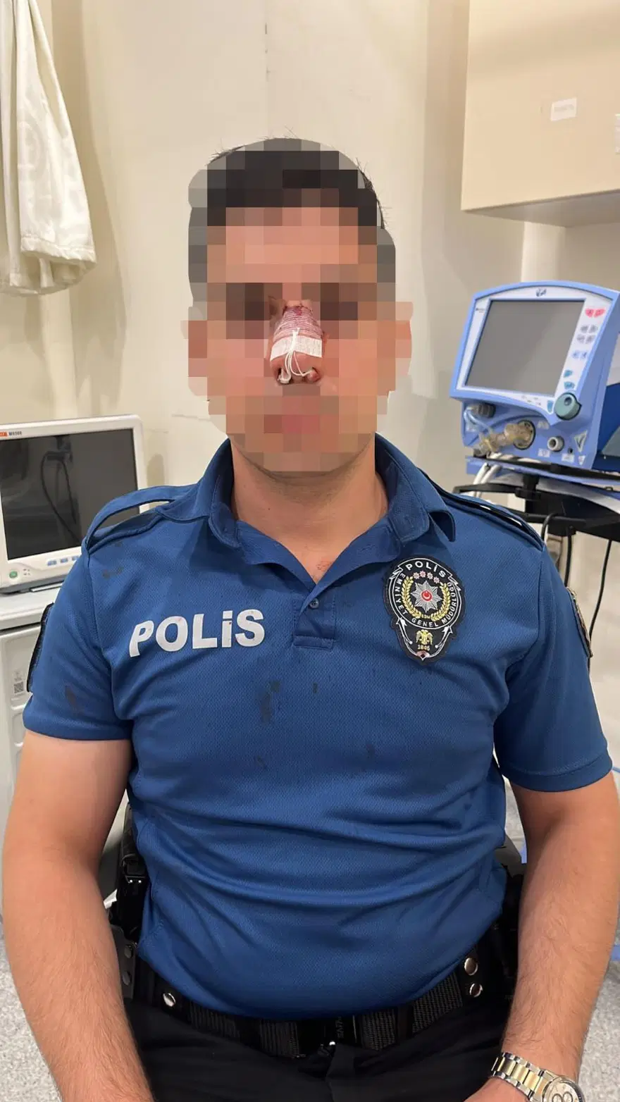 POLİSİN BURNU KIRILDI 4 POLİSİN BURNU KIRILDI 4