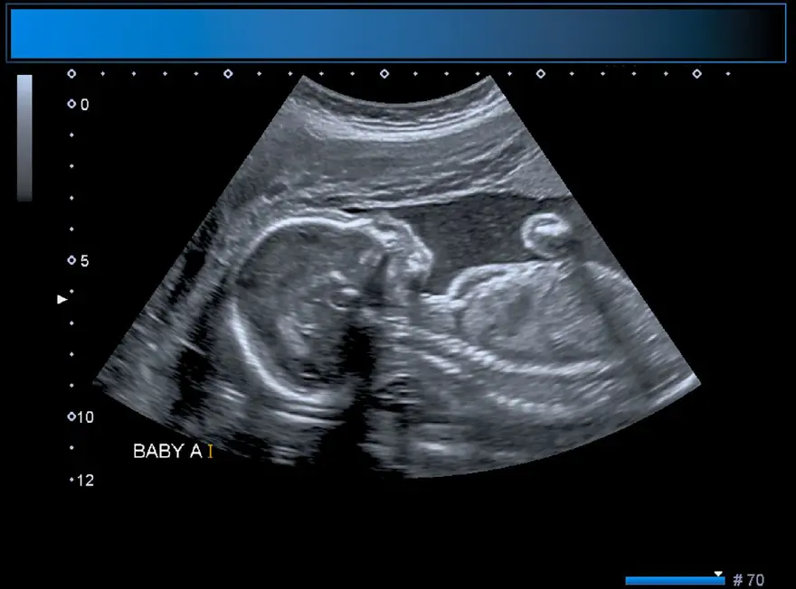 DAHA ÖNCE DE GÖRÜLDÜ 5