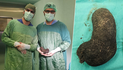 "Midem bulanıyor" dedi, midesinden çıkanlar doktorları şaşırttı