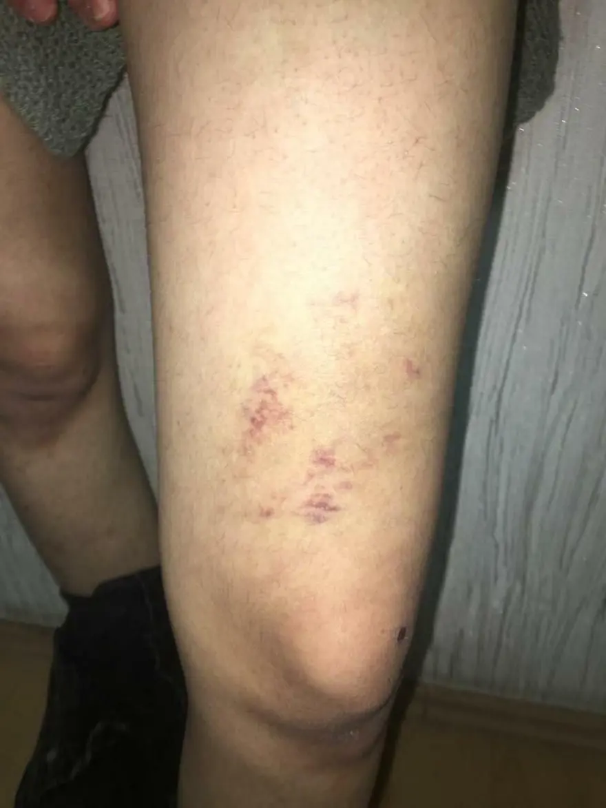 İŞKENCE VE CİNSEL SALDIRI 6