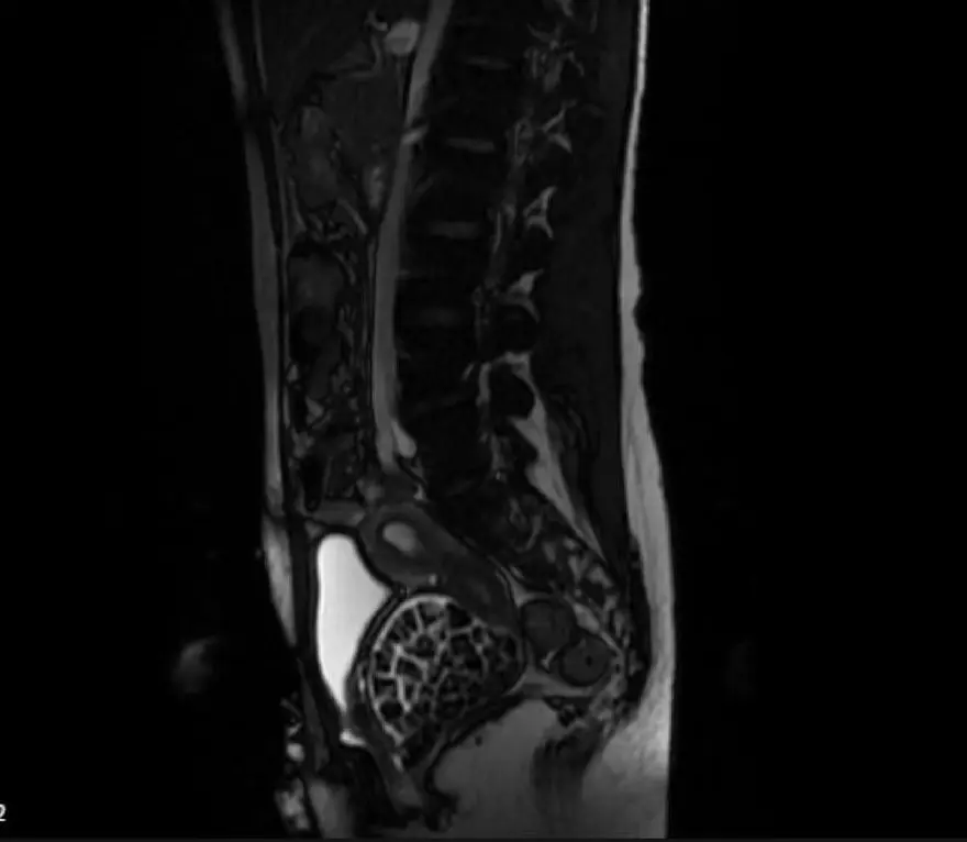 "BU KADAR TAŞ BEKLEMİYORDUK, RESMEN ÇAKIL TAŞI" 3