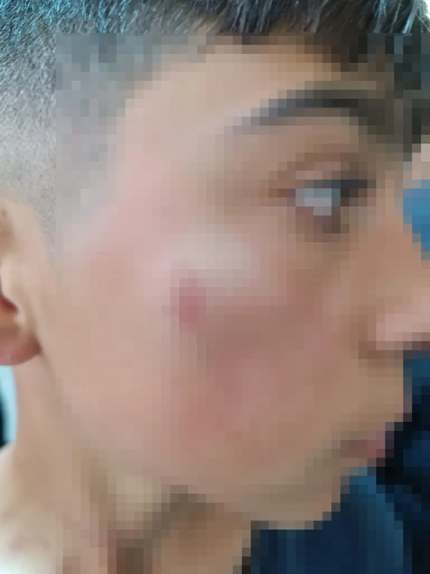 13 yaşındaki öğrenciyi, arkadaşının babası tokatladı 2