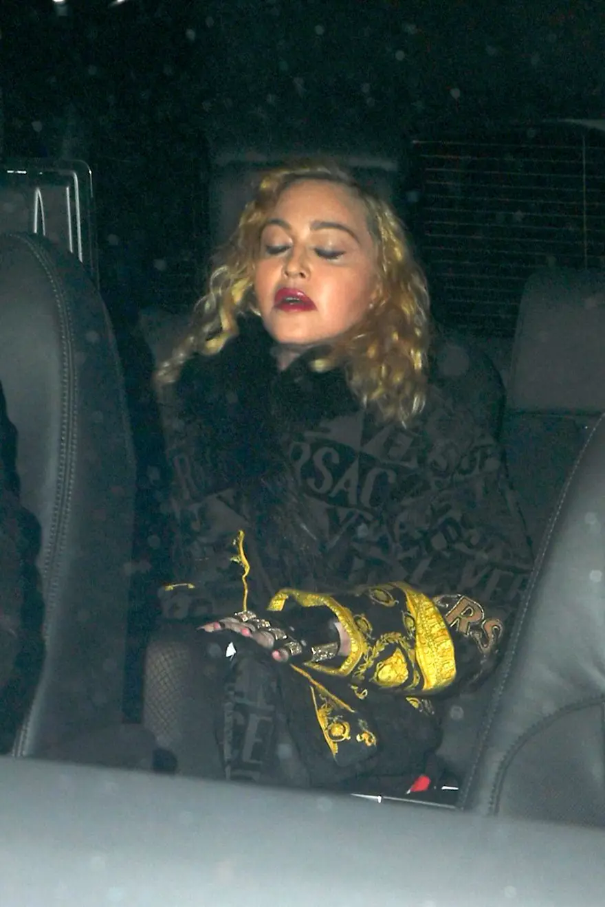 Madonna’nın son hali (Hastalık mı estetik mi?) 5