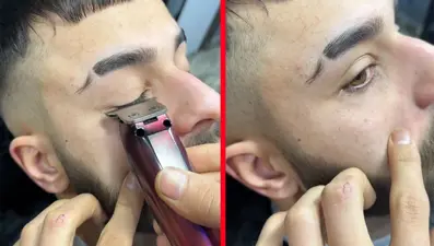 Tiktok'ta "Kirpik kesme akımı" tehlikesi: Gözde kalıcı hasar bırakabilir