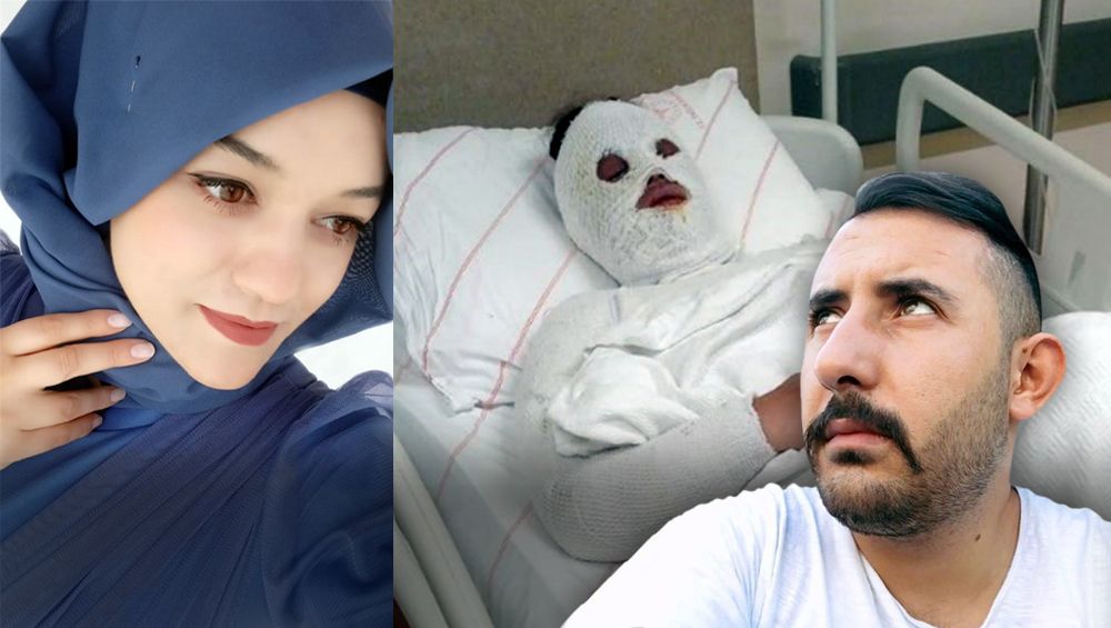 Konya'da eski nişanlıya kimyasal saldırı | 3 gün önce koruma kararı istemiş