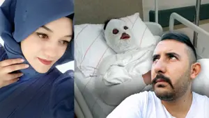 Konya'da eski nişanlıya kimyasal saldırı: Keşif görüntüleri ortaya çıktı Konya'da eski nişanlıya kimyasal saldırı: Keşif görüntüleri ortaya çıktı