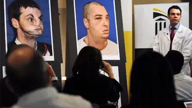 Bir yüz nakli haberi de ABD'den